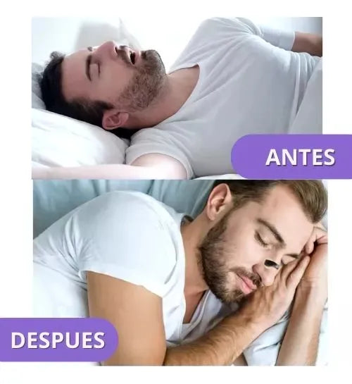 AIRMAX DILATADOR NASAL MAGNÉTICO